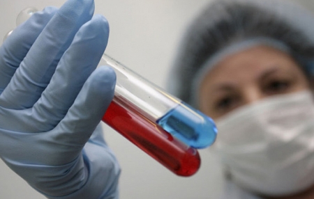 Роспотребнадзор. Специфическая форма чумы в Китае.